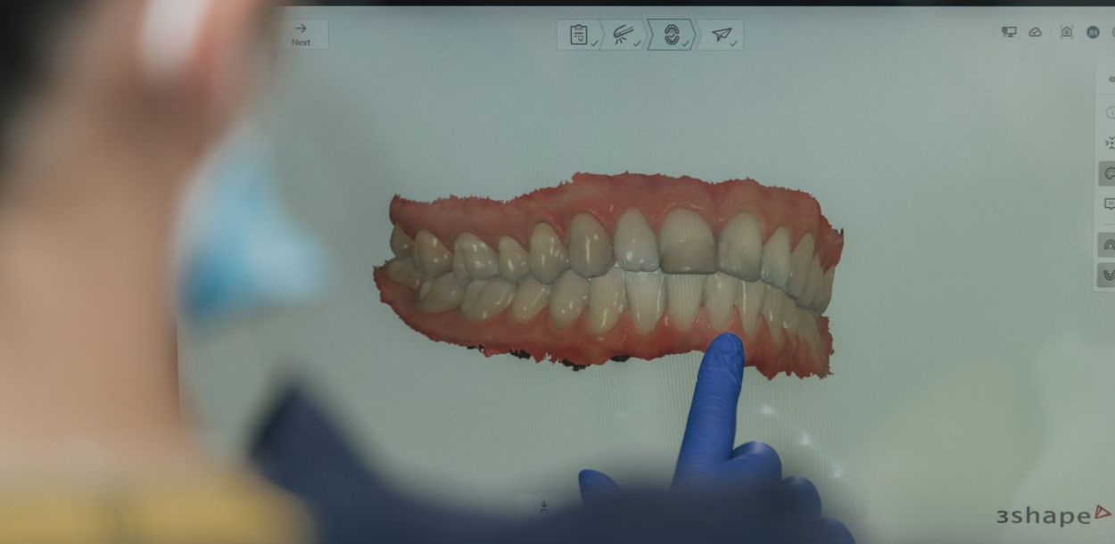 SureSmile Aligners at Cleveland